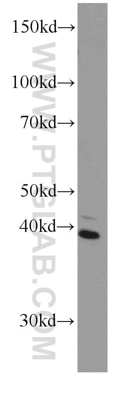 Western Blot (WB) analysis of human brain tissue using BBS5 Monoclonal antibody (66136-1-Ig)