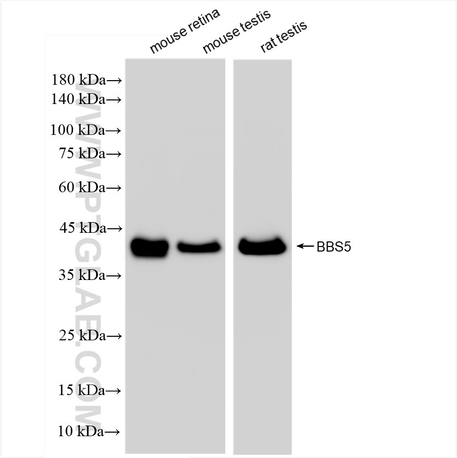 Western Blot (WB) analysis of various lysates using BBS5 Recombinant antibody (83722-1-RR)