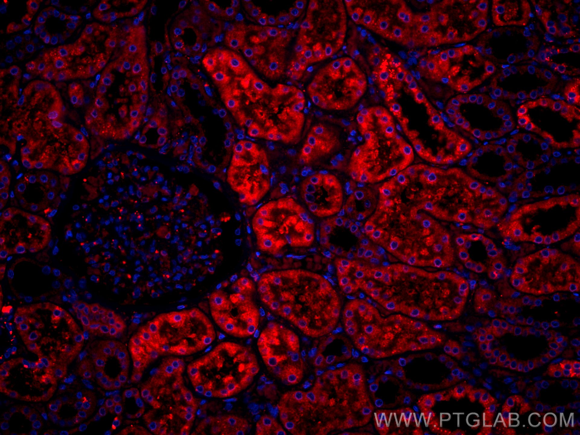 Immunofluorescence (IF) / fluorescent staining of human kidney tissue using CoraLite®594-conjugated BBS5 Monoclonal antibody (CL594-66136)