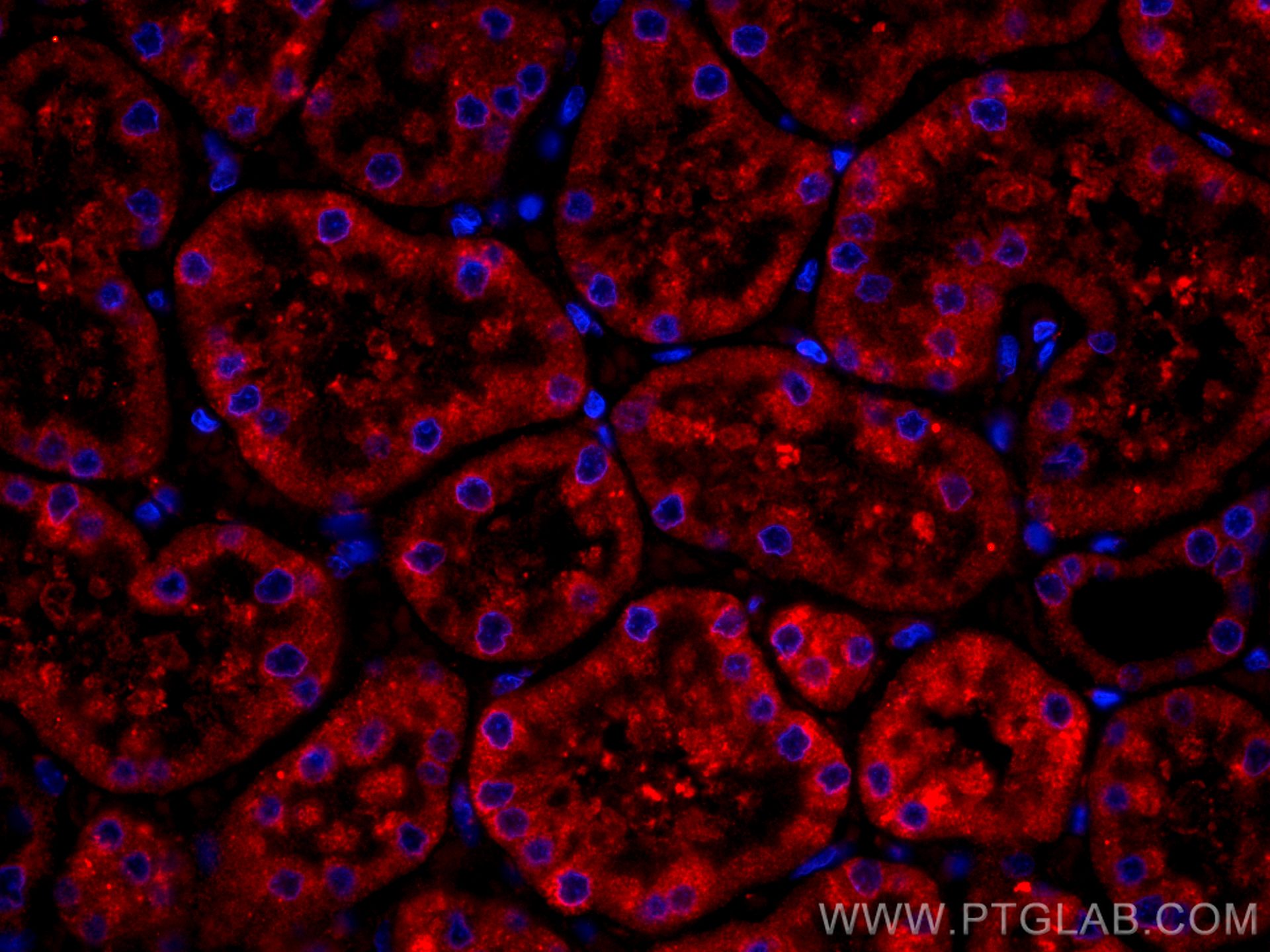 Immunofluorescence (IF) / fluorescent staining of human kidney tissue using CoraLite®594-conjugated BBS5 Monoclonal antibody (CL594-66136)