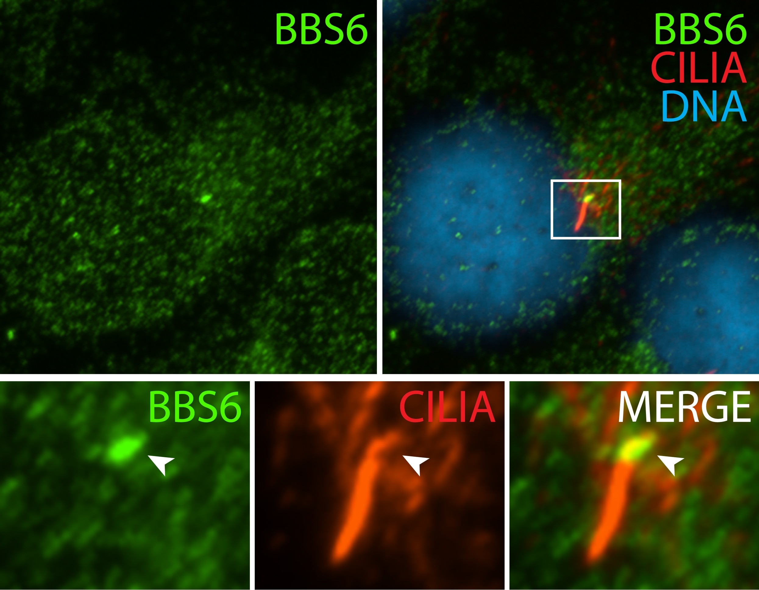 Immunofluorescence (IF) / fluorescent staining of hTERT-RPE1 cells using BBS6 Polyclonal antibody (13078-1-AP)
