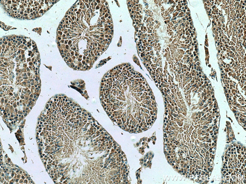 Immunohistochemistry (IHC) staining of mouse testis tissue using BBS6 Polyclonal antibody (13078-1-AP)