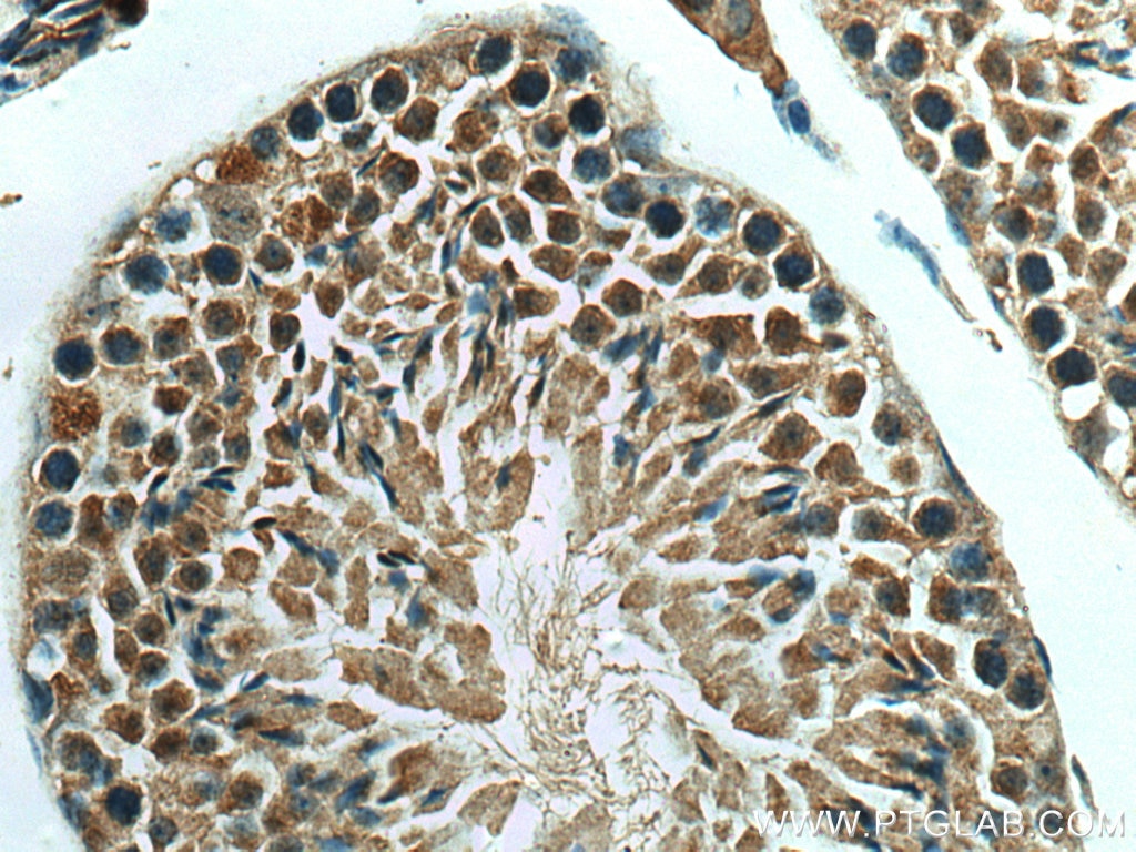 Immunohistochemistry (IHC) staining of mouse testis tissue using BBS6 Polyclonal antibody (13078-1-AP)