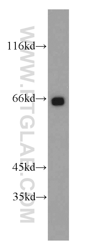 Western Blot (WB) analysis of mouse testis tissue using BBS6 Polyclonal antibody (13078-1-AP)