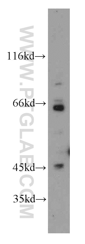 Western Blot (WB) analysis of mouse brain tissue using BBS6 Polyclonal antibody (13078-1-AP)