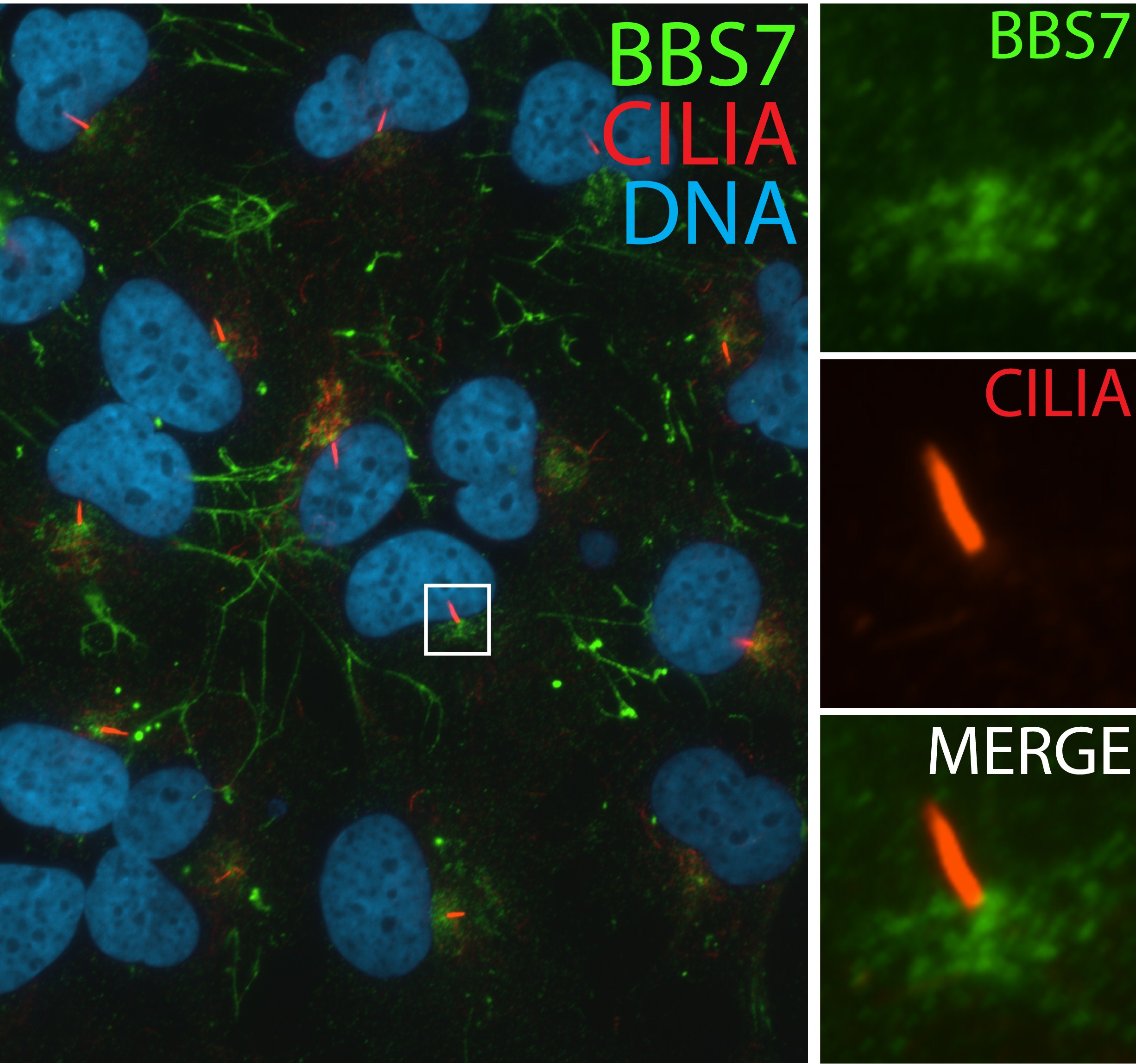 Immunofluorescence (IF) / fluorescent staining of hTERT-RPE1 cells using BBS7 Polyclonal antibody (13458-1-AP)