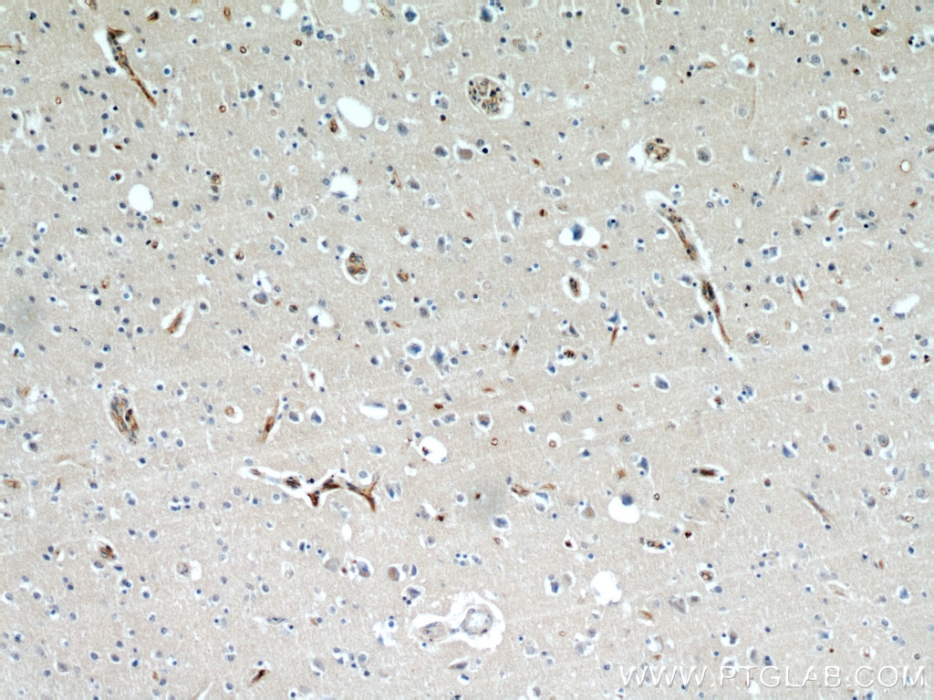 Immunohistochemistry (IHC) staining of human brain tissue using BBS7 Polyclonal antibody (18961-1-AP)