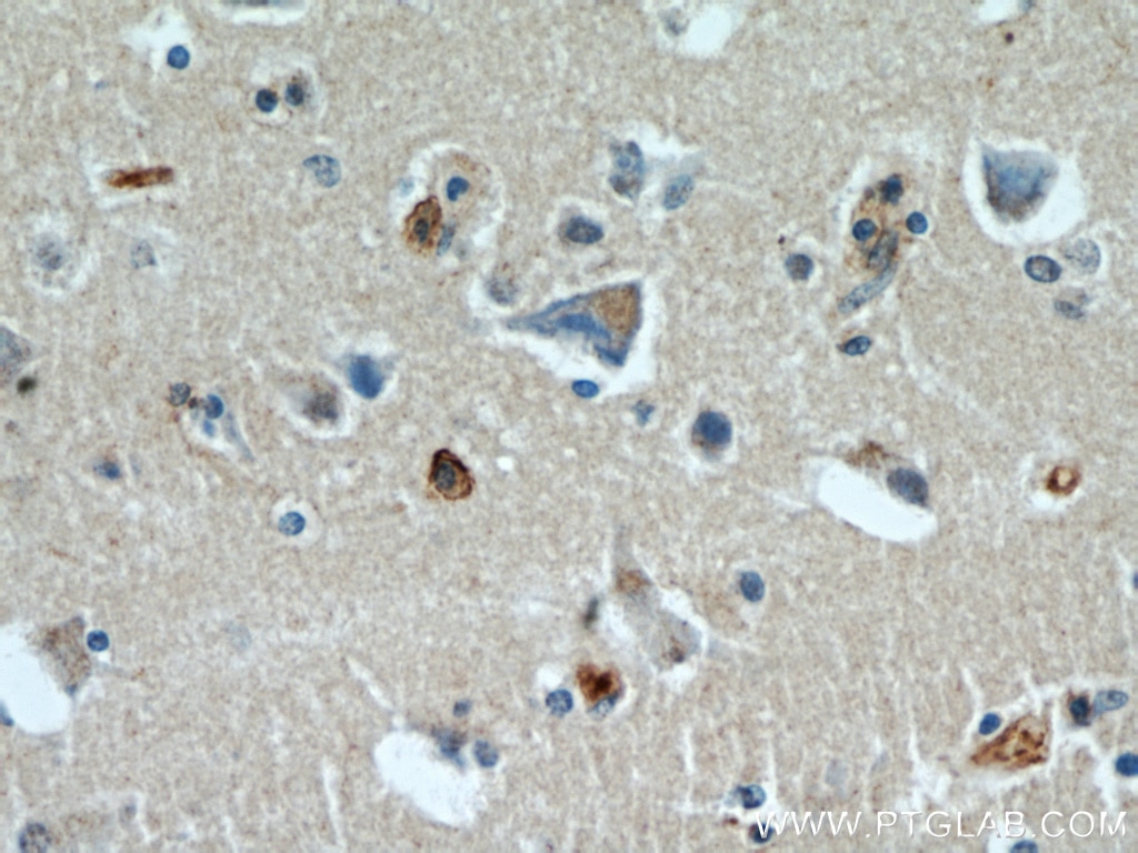 Immunohistochemistry (IHC) staining of human brain tissue using BBS7 Polyclonal antibody (18961-1-AP)