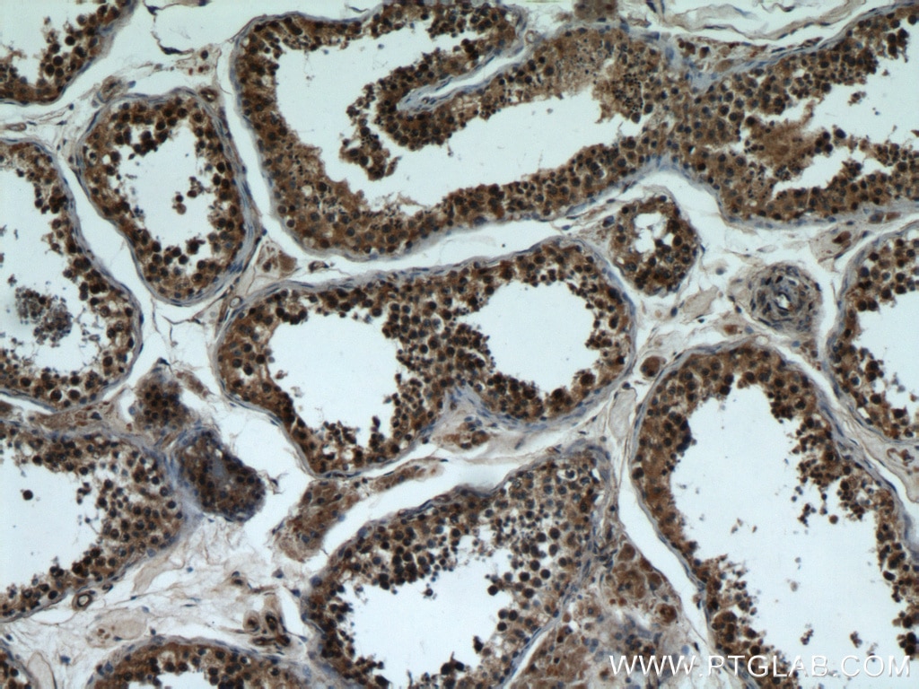 Immunohistochemistry (IHC) staining of human testis tissue using BBS7 Polyclonal antibody (18961-1-AP)
