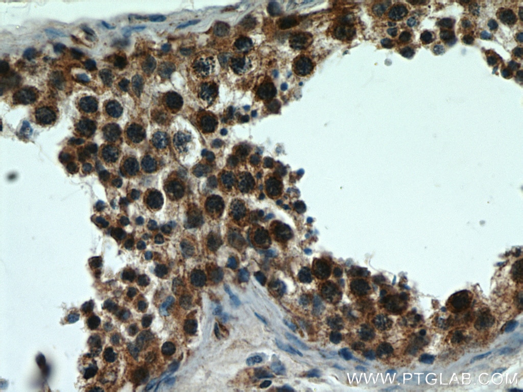 Immunohistochemistry (IHC) staining of human testis tissue using BBS7 Polyclonal antibody (18961-1-AP)