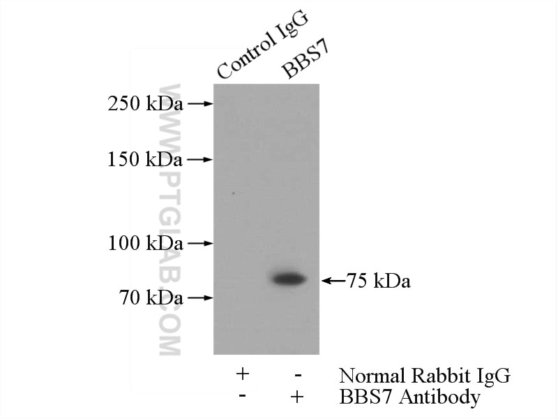 Immunoprecipitation (IP) experiment of mouse testis tissue using BBS7 Polyclonal antibody (18961-1-AP)