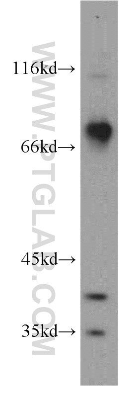 Western Blot (WB) analysis of human brain tissue using BBS7 Polyclonal antibody (18961-1-AP)