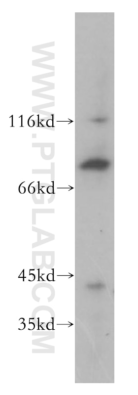 Western Blot (WB) analysis of human brain tissue using BBS7 Polyclonal antibody (18961-1-AP)