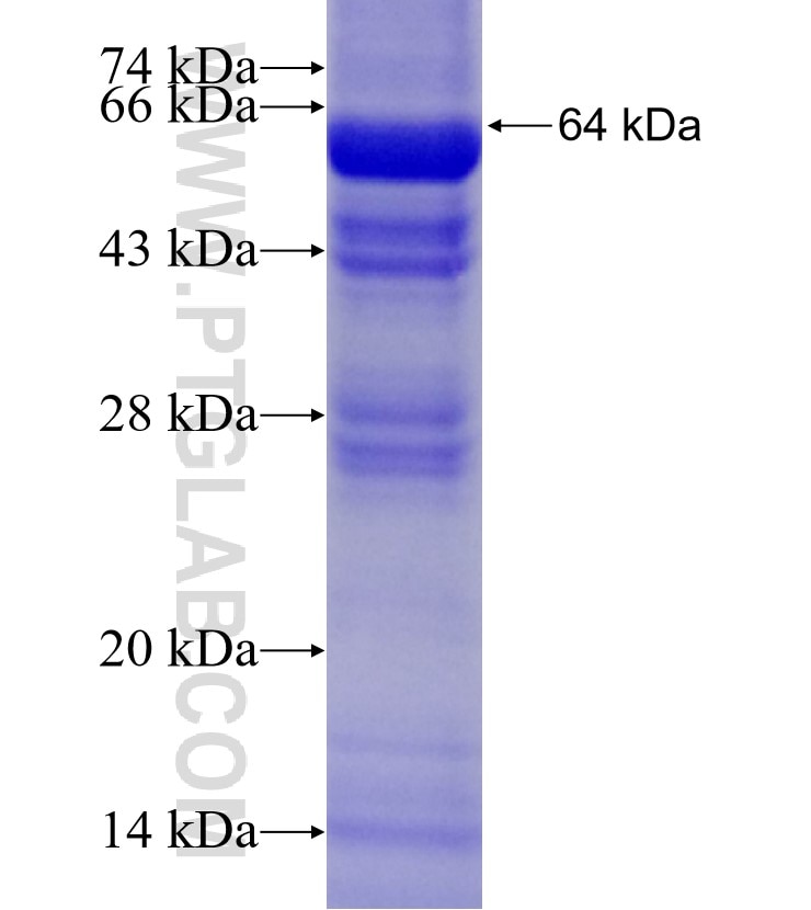 BBS7 fusion protein Ag4314 SDS-PAGE