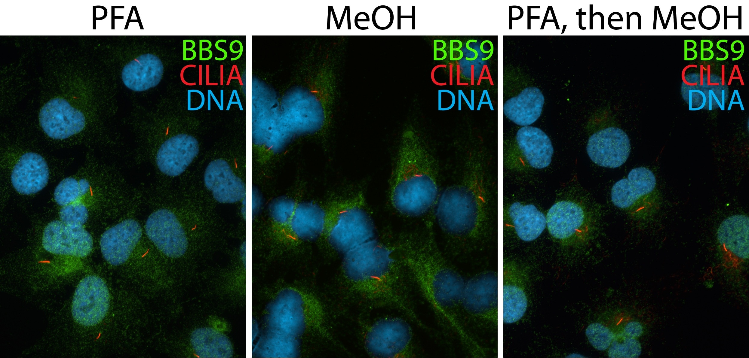 Immunofluorescence (IF) / fluorescent staining of hTERT-RPE1 cells using BBS9 Polyclonal antibody (14460-1-AP)