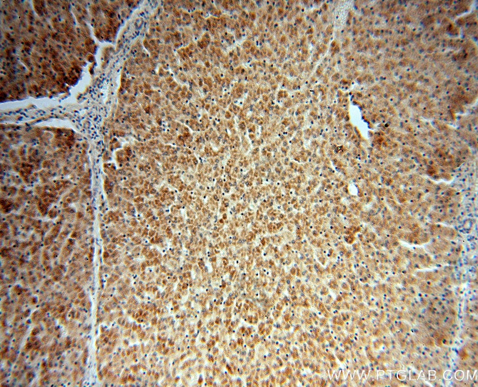 Immunohistochemistry (IHC) staining of human liver tissue using BBS9 Polyclonal antibody (14460-1-AP)