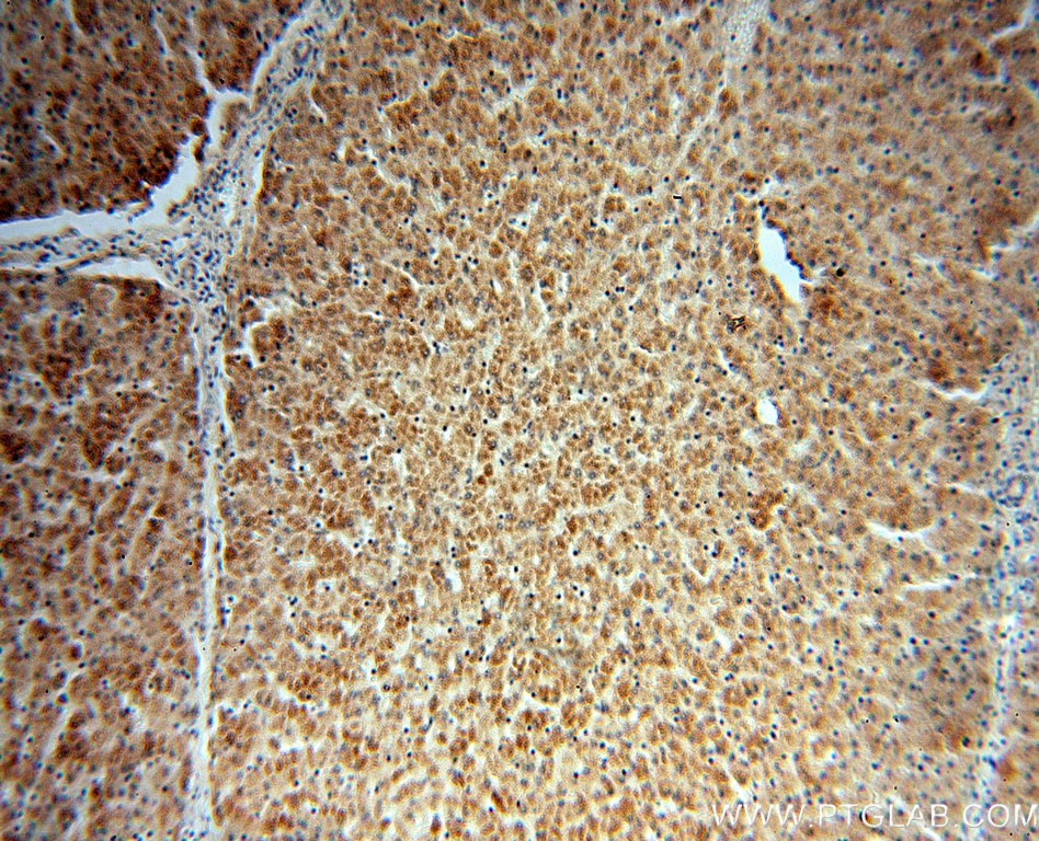 IHC staining of human liver using 14460-1-AP