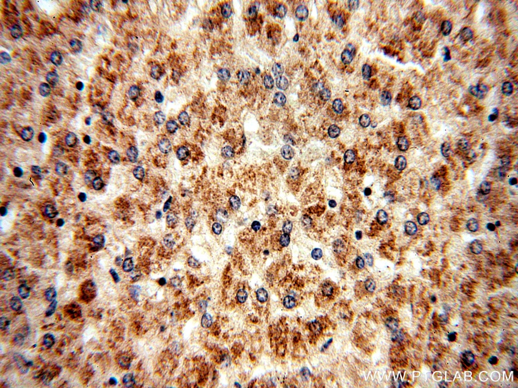 Immunohistochemistry (IHC) staining of human liver tissue using BBS9 Polyclonal antibody (14460-1-AP)