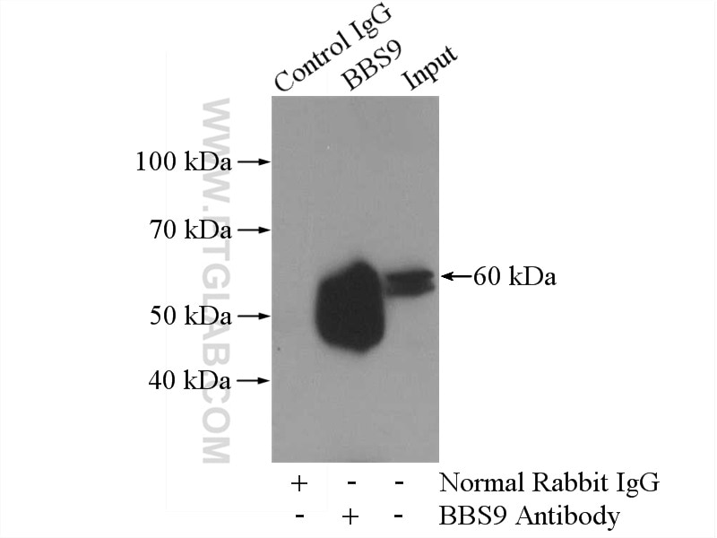 Immunoprecipitation (IP) experiment of mouse testis tissue using BBS9 Polyclonal antibody (14460-1-AP)