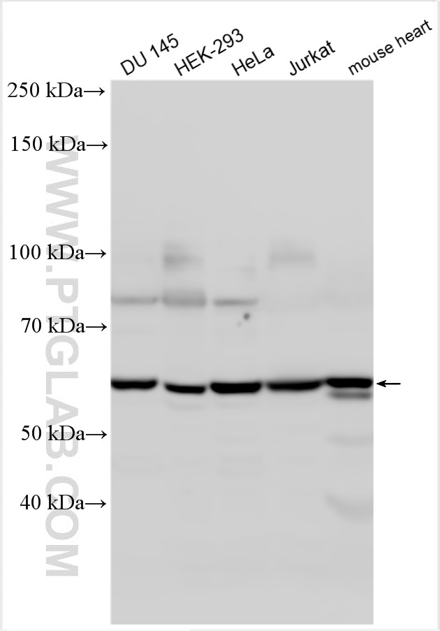 Western Blot (WB) analysis of various lysates using BBS9 Polyclonal antibody (14460-1-AP)