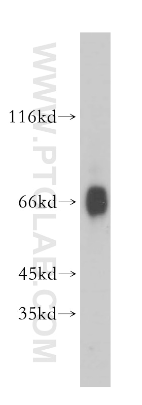 Western Blot (WB) analysis of mouse testis tissue using BBS9 Polyclonal antibody (14460-1-AP)