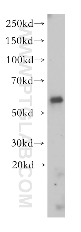 Western Blot (WB) analysis of human heart tissue using BBS9 Polyclonal antibody (14460-1-AP)