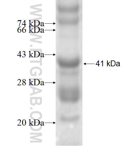 BBS9 fusion protein Ag5665 SDS-PAGE