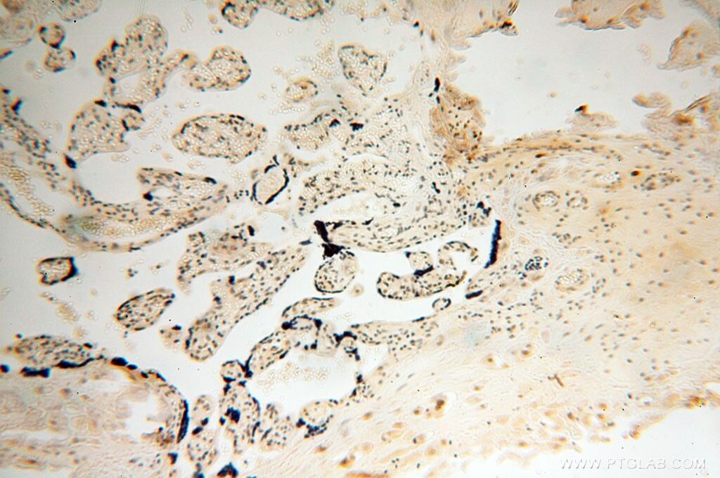 Immunohistochemistry (IHC) staining of human placenta tissue using BBX Polyclonal antibody (17254-1-AP)
