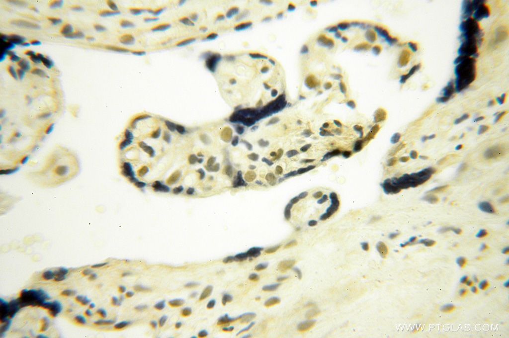Immunohistochemistry (IHC) staining of human placenta tissue using BBX Polyclonal antibody (17254-1-AP)