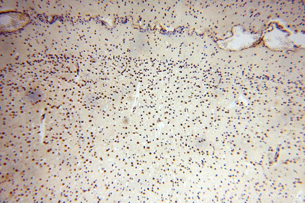 Immunohistochemistry (IHC) staining of human brain tissue using BBX Polyclonal antibody (17254-1-AP)