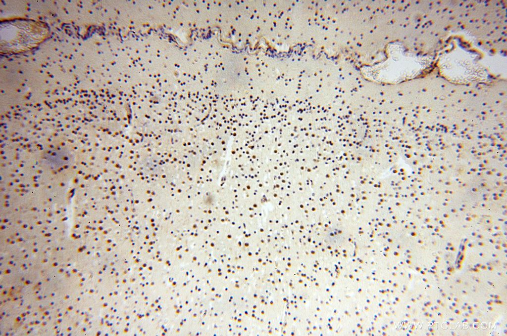 IHC staining of human brain using 17254-1-AP