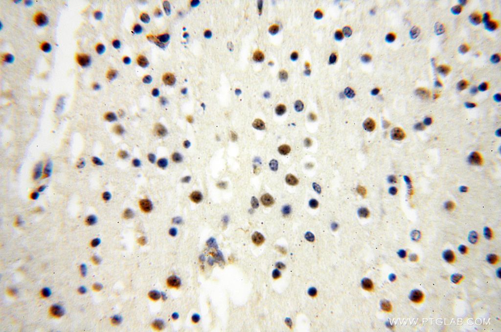 IHC staining of human brain using 17254-1-AP