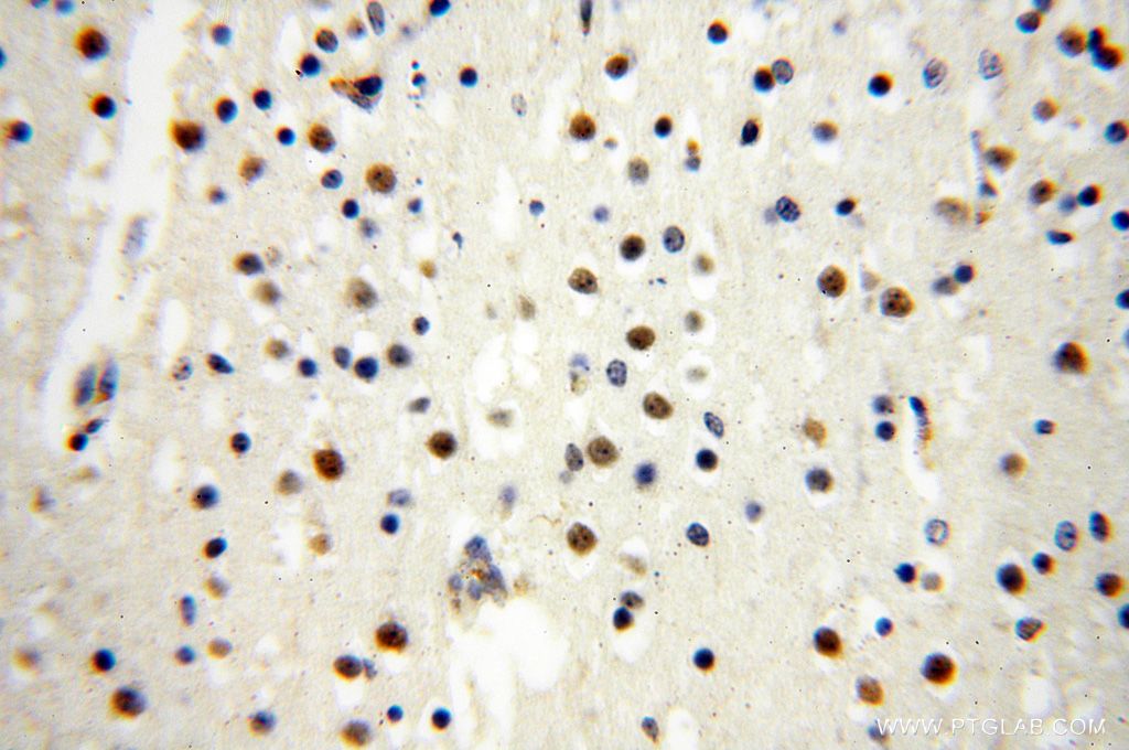 Immunohistochemistry (IHC) staining of human brain tissue using BBX Polyclonal antibody (17254-1-AP)