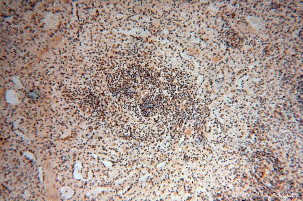 Immunohistochemistry (IHC) staining of human spleen tissue using BBX Polyclonal antibody (17254-1-AP)