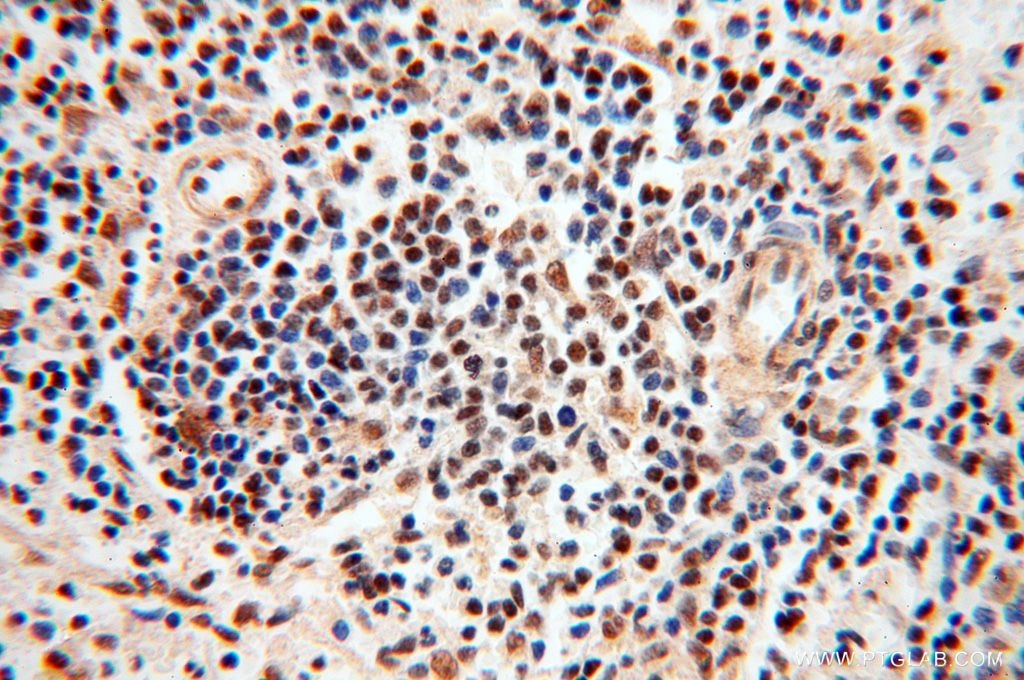 Immunohistochemistry (IHC) staining of human spleen tissue using BBX Polyclonal antibody (17254-1-AP)