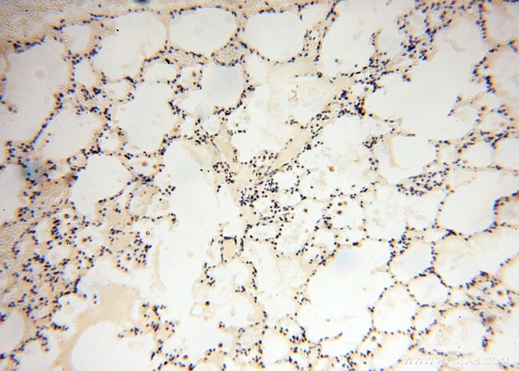 Immunohistochemistry (IHC) staining of human lung tissue using BBX Polyclonal antibody (17254-1-AP)