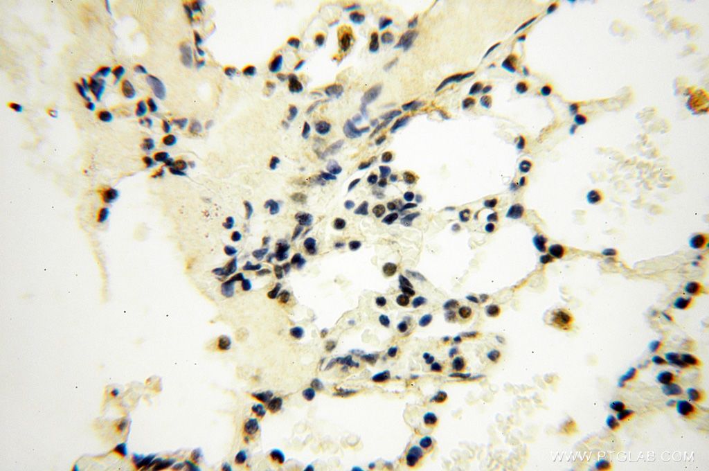 Immunohistochemistry (IHC) staining of human lung tissue using BBX Polyclonal antibody (17254-1-AP)