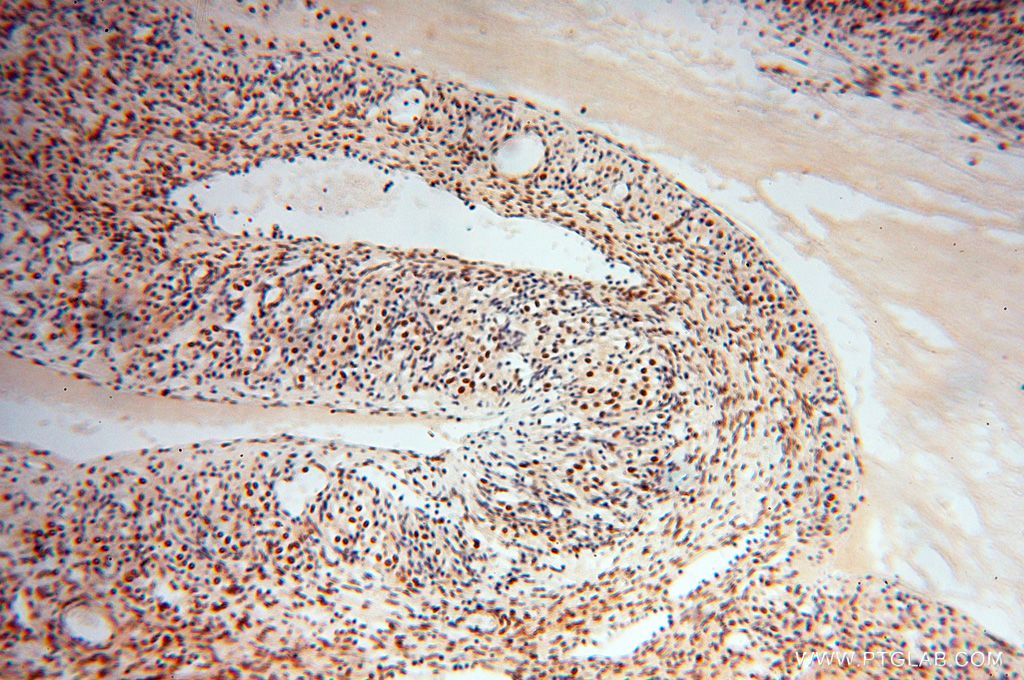 Immunohistochemistry (IHC) staining of human ovary tissue using BBX Polyclonal antibody (17254-1-AP)