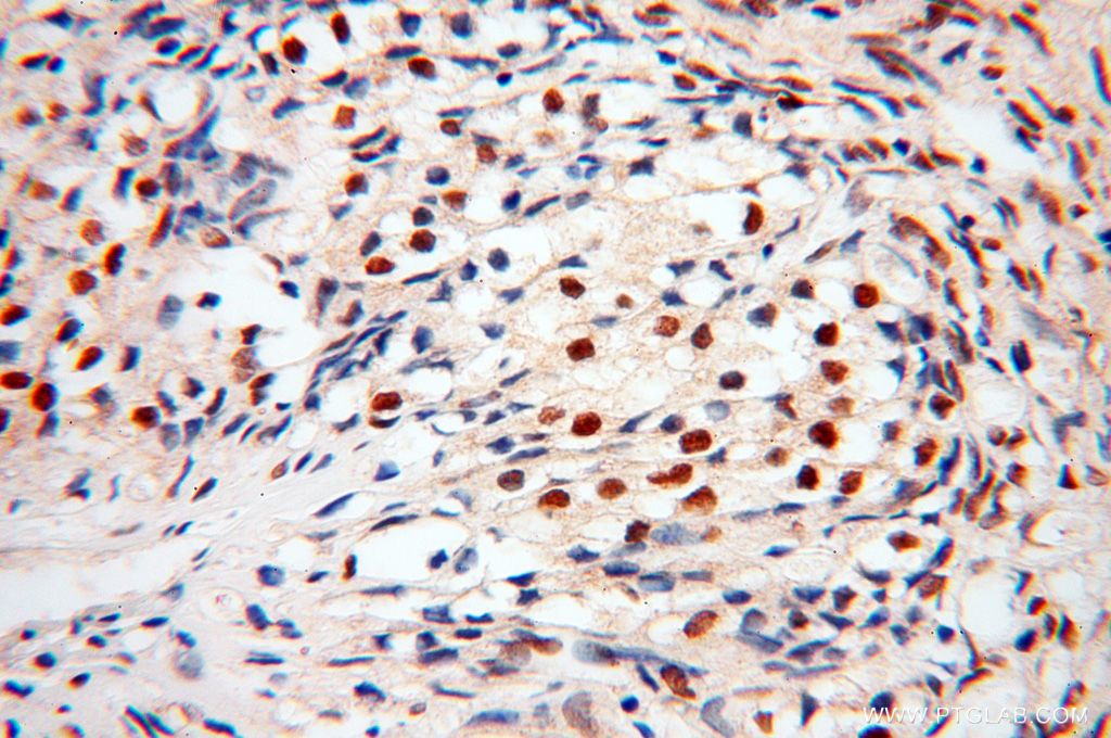 Immunohistochemistry (IHC) staining of human ovary tissue using BBX Polyclonal antibody (17254-1-AP)