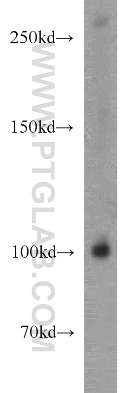 Western Blot (WB) analysis of HepG2 cells using BBX Polyclonal antibody (17254-1-AP)