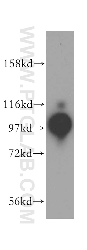 Western Blot (WB) analysis of HepG2 cells using BBX Polyclonal antibody (17254-1-AP)