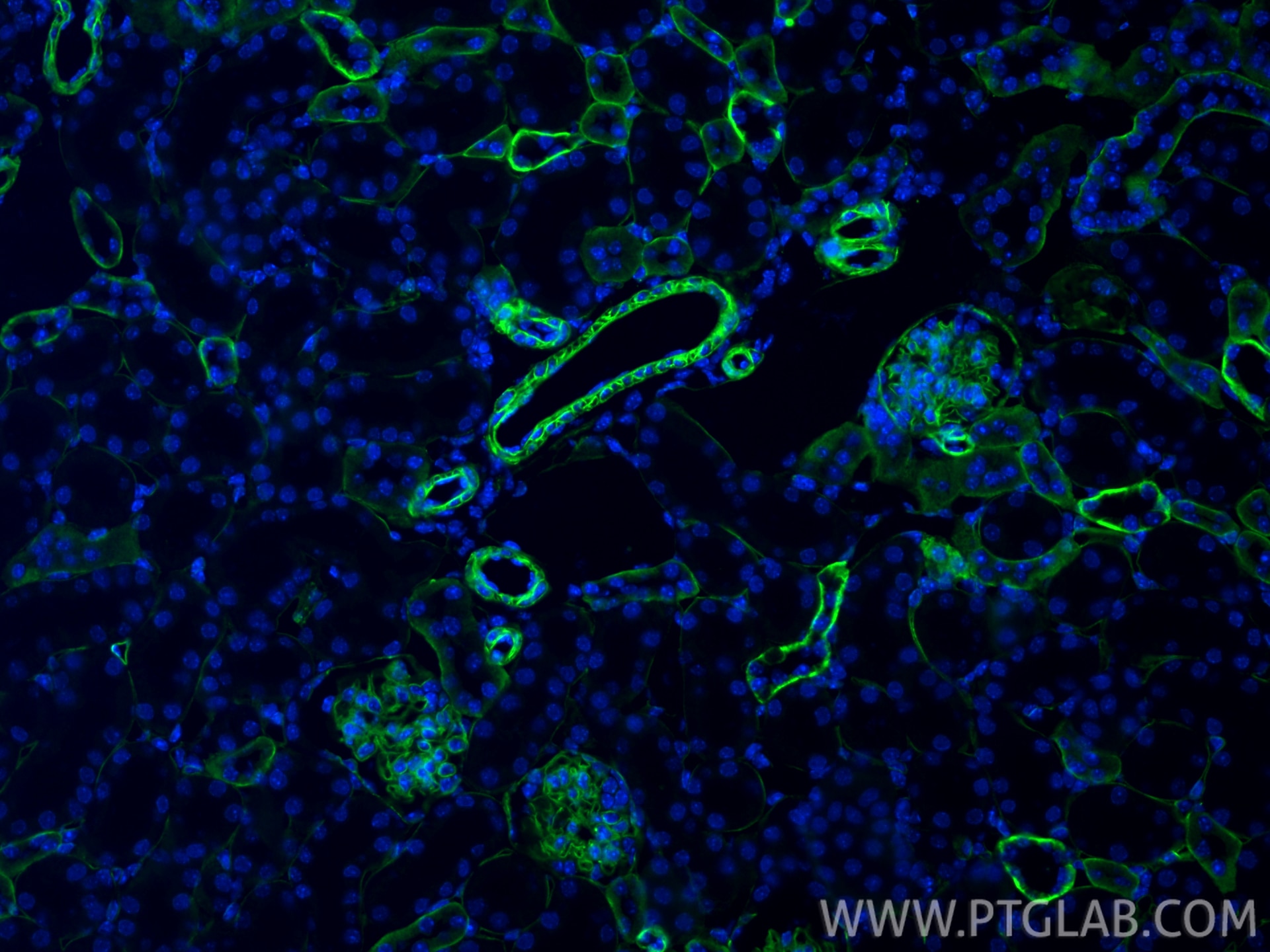 Immunofluorescence (IF) / fluorescent staining of mouse kidney tissue using CD239/BCAM Polyclonal antibody (33665-1-AP)