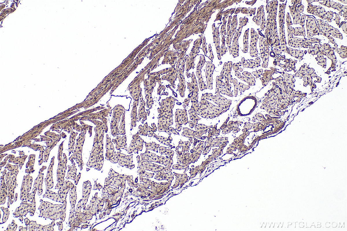Immunohistochemistry (IHC) staining of mouse heart tissue using CD239/BCAM Polyclonal antibody (33665-1-AP)