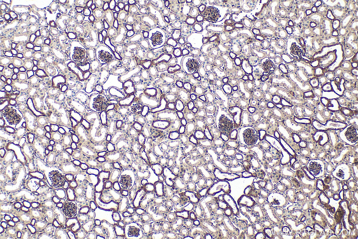 Immunohistochemistry (IHC) staining of mouse kidney tissue using CD239/BCAM Polyclonal antibody (33665-1-AP)