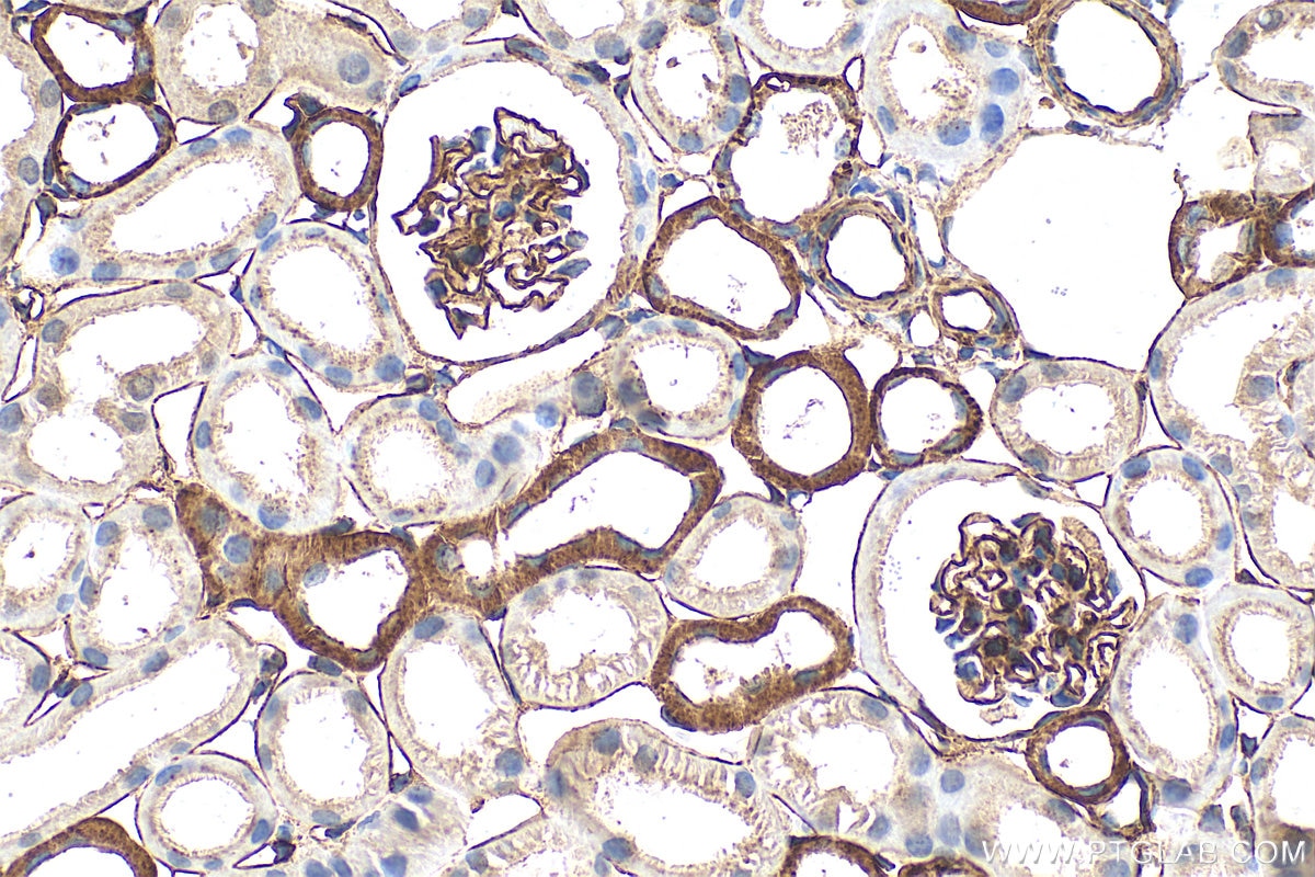 Immunohistochemistry (IHC) staining of mouse kidney tissue using CD239/BCAM Polyclonal antibody (33665-1-AP)
