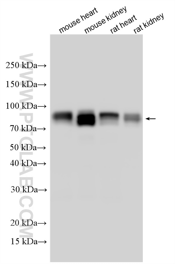 Western Blot (WB) analysis of various lysates using CD239/BCAM Polyclonal antibody (33665-1-AP)