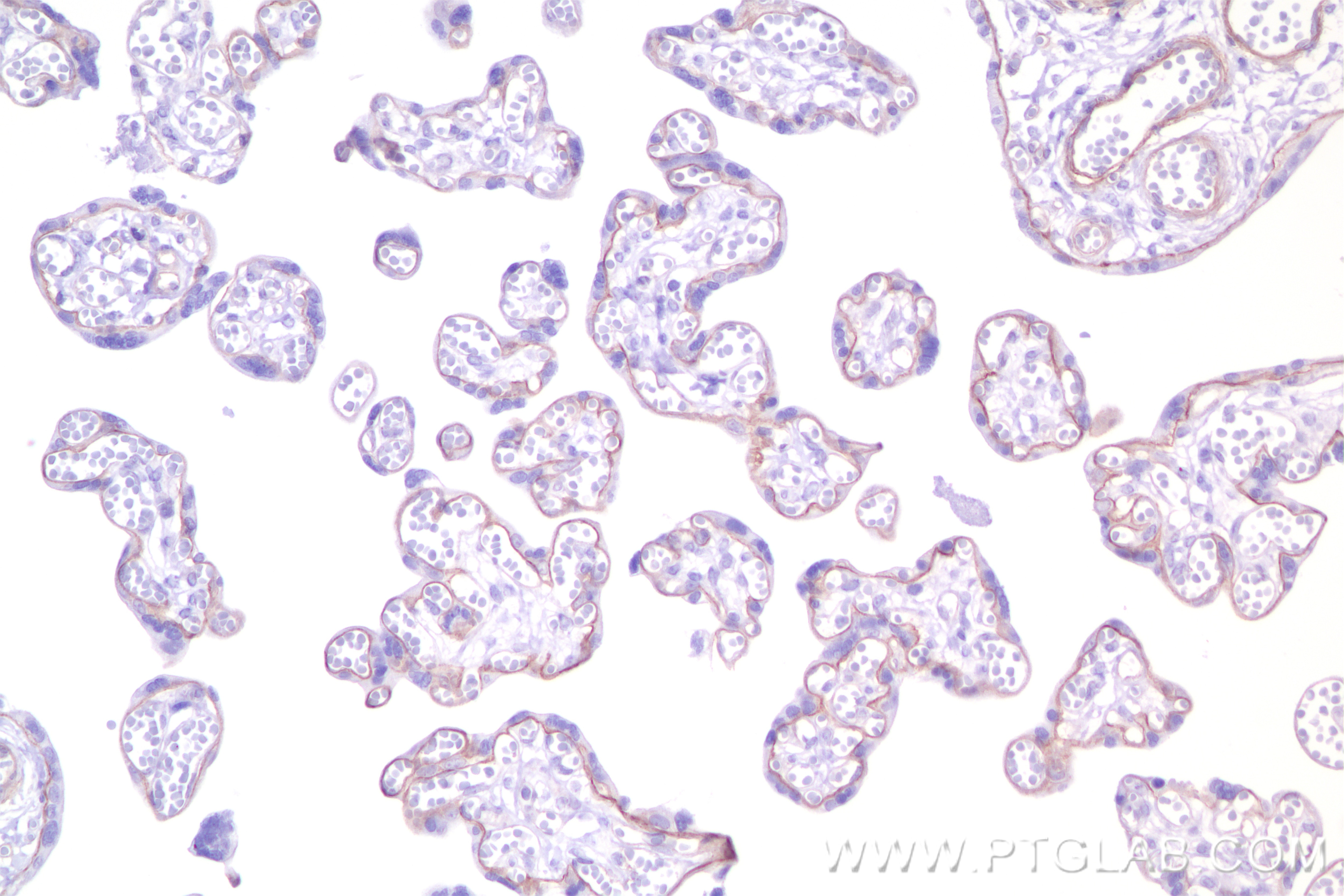Immunohistochemistry (IHC) staining of human placenta tissue using BCAM Recombinant antibody (84038-3-RR)