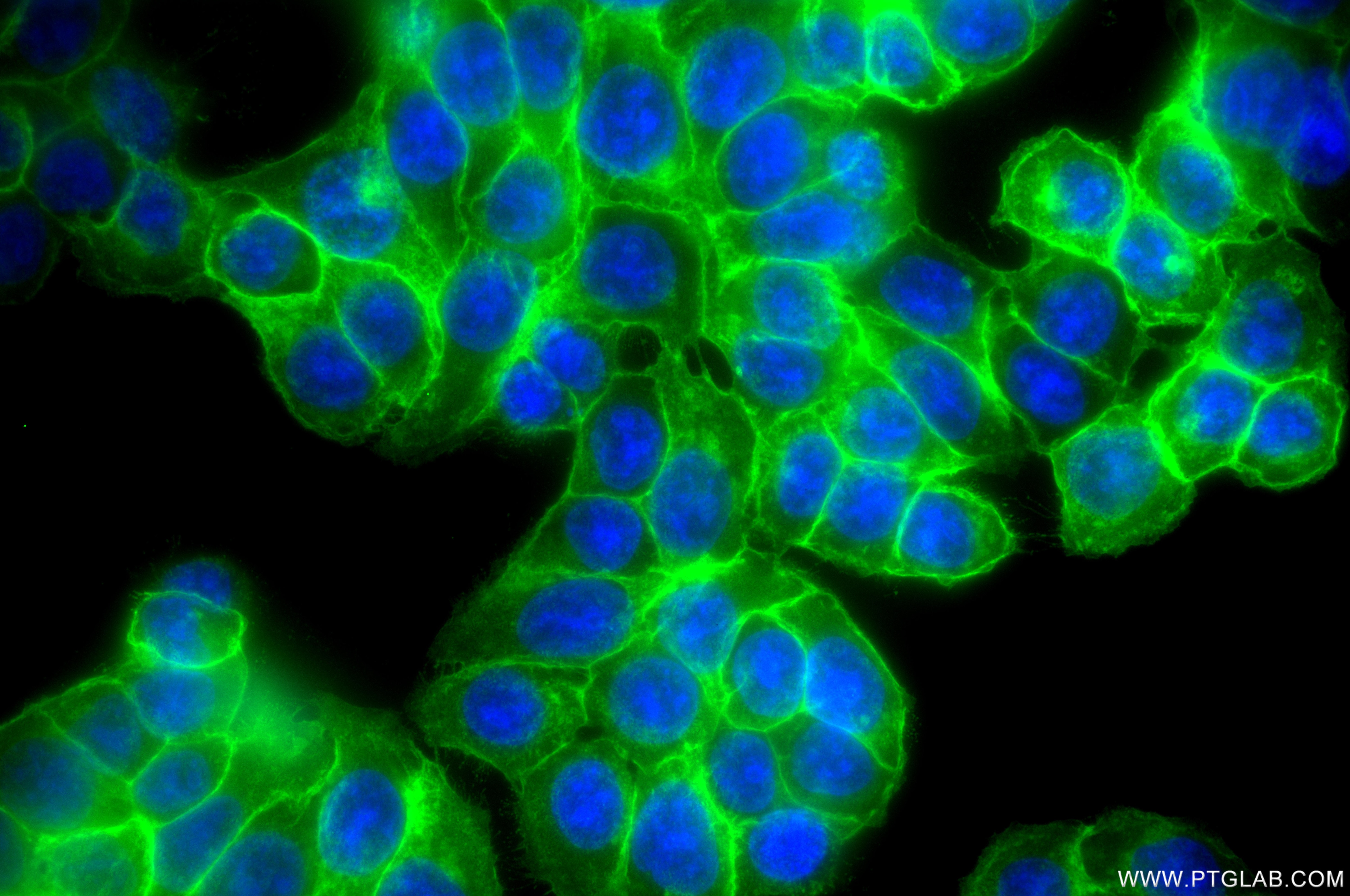IF Staining of HT-29 using 98521-3-RR Immunofluorescence (IF) / fluorescent staining of HT-29 cells using Anti-Human BCAM Rabbit Recombinant Antibody (98521-3-RR)