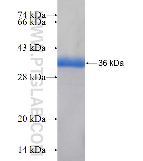 BCAM fusion protein Ag24753 SDS-PAGE