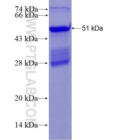BCAM fusion protein Ag28181 SDS-PAGE